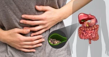 حصوات المرارة المتكررة.. 7 خطوات لتقليل مخاطر الإصابة بها