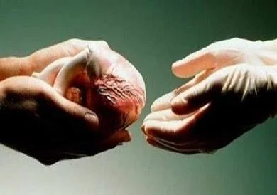 نقل أعضاء من جسد طفل.. ما العقوبة التي حددها القانون؟